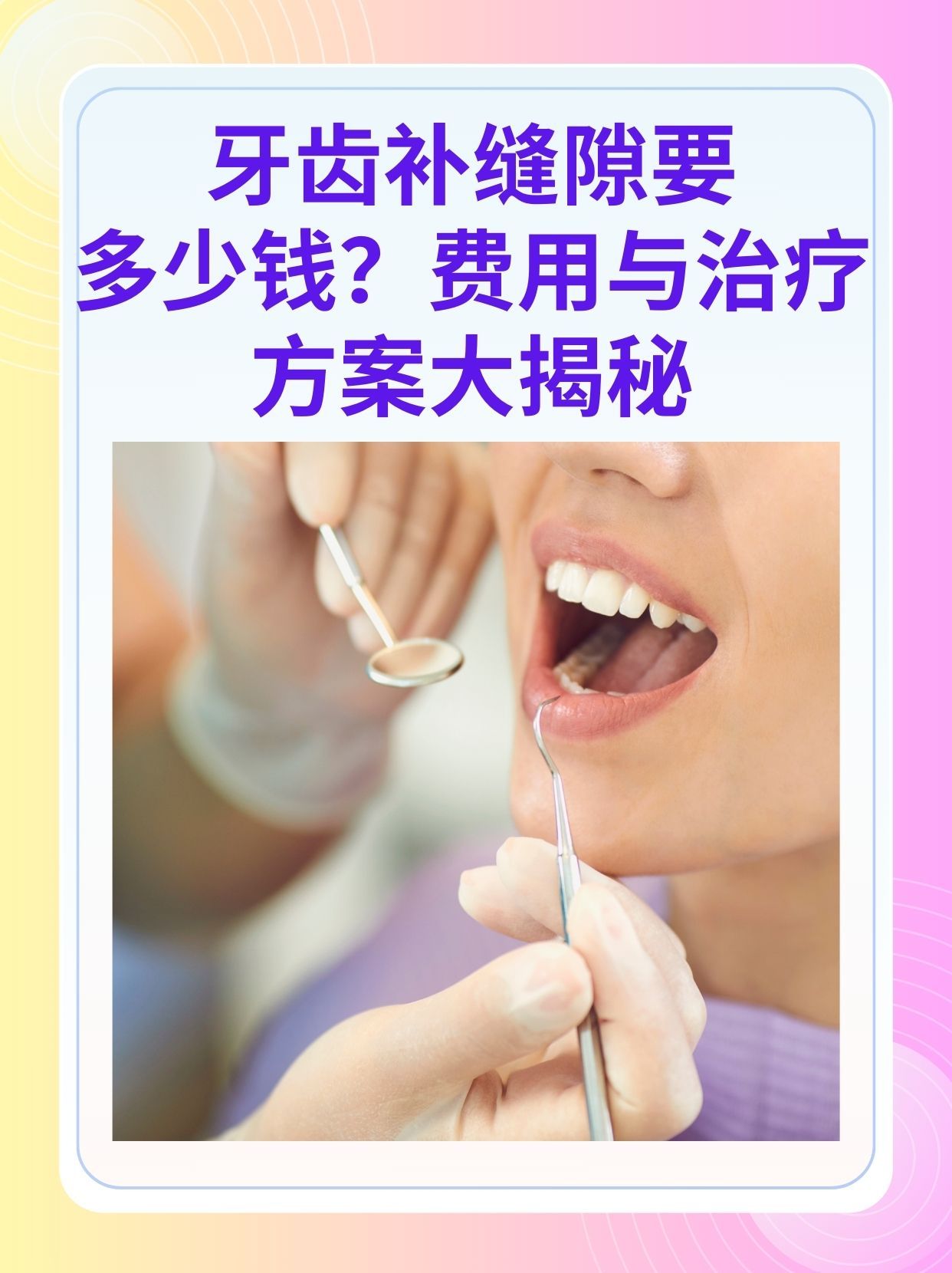 荆州补牙医保可以报销吗(补牙医保可以报销吗 哪些可以报销呢)